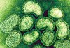 swine_influenza_flu_virus_a_h1n1_2009_outbreak.jpg